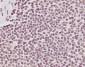 Anti-Phospho-POLR2A (S2) Rabbit Monoclonal Antibody