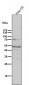 Anti-Phospho-PKA R2 (S99) PRKAR2A Rabbit Monoclonal Antibody