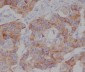 Anti-Phospho-mTOR (S2448) Rabbit Monoclonal Antibody