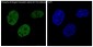 Anti-Phospho-ER alpha (S118) ESR1 Rabbit Monoclonal Antibody