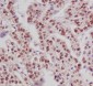 Anti-Phospho-ER alpha (S118) ESR1 Rabbit Monoclonal Antibody