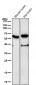Anti-Phospho-ER alpha (S118) ESR1 Rabbit Monoclonal Antibody
