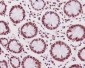 Anti-Phospho-DNA PKcs (S2056) PRKDC Rabbit Monoclonal Antibody