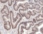 Anti-Phospho-DNA PKcs (S2056) PRKDC Rabbit Monoclonal Antibody