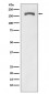 Anti-Phospho-PDGF Receptor beta (Y740) PDGFRB Rabbit Monoclonal Antibody