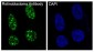 Anti-Rb RB1 Rabbit Monoclonal Antibody