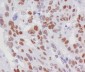 Anti-Rb RB1 Rabbit Monoclonal Antibody