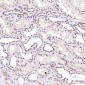Anti-Rb RB1 Rabbit Monoclonal Antibody