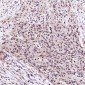 Anti-Rb RB1 Rabbit Monoclonal Antibody