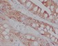 Anti-CD8 CD8A Rabbit Monoclonal Antibody