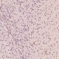 Anti-CD8 CD8A Rabbit Monoclonal Antibody