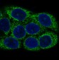 Anti-NSE ENO2 Rabbit Monoclonal Antibody