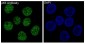 Anti-p63 TP63 Rabbit Monoclonal Antibody