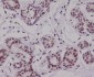 Anti-p63 TP63 Rabbit Monoclonal Antibody