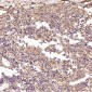 Anti-p63 TP63 Rabbit Monoclonal Antibody
