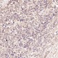 Anti-p63 TP63 Rabbit Monoclonal Antibody