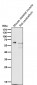 Anti-p63 TP63 Rabbit Monoclonal Antibody