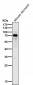 Anti-p63 TP63 Rabbit Monoclonal Antibody