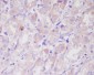 Anti-ILK/Integrin Linked Ilk Rabbit Monoclonal Antibody
