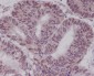 Anti-BTK Rabbit Monoclonal Antibody