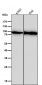 Anti-BTK Rabbit Monoclonal Antibody