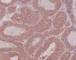 Anti-Rho RHOA Rabbit Monoclonal Antibody