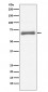 Anti-AFP/Alpha 1 Fetoprotein Rabbit Monoclonal Antibody