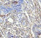 Anti-LOX Rabbit Monoclonal Antibody