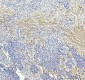 Anti-LOX Rabbit Monoclonal Antibody