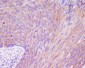 Anti-DSG1/Desmoglein 1 Rabbit Monoclonal Antibody
