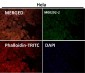 Anti-MEK1 MAP2K1 Rabbit Monoclonal Antibody