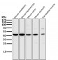 Anti-MEK1 MAP2K1 Rabbit Monoclonal Antibody
