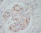 Anti-VEGF VEGFA Rabbit Monoclonal Antibody