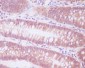 Anti-ENO1/Alpha Enolase Rabbit Monoclonal Antibody