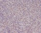 Anti-PMS2 Rabbit Monoclonal Antibody