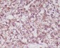 Anti-MMP3 Rabbit Monoclonal Antibody