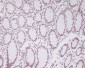 Anti-Pax2 Rabbit Monoclonal Antibody