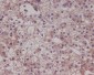 Anti-LRP1/Lrp 1 Cluster Ii Rabbit Monoclonal Antibody