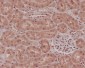 Anti-NOX4 Rabbit Monoclonal Antibody