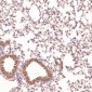 Anti-CD45 PTPRC Rabbit Monoclonal Antibody