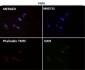 Anti-MMP1 Rabbit Monoclonal Antibody