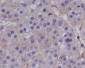 Anti-MMP1 Rabbit Monoclonal Antibody