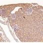 Anti-MMP1 Rabbit Monoclonal Antibody