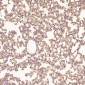 Anti-MMP1 Rabbit Monoclonal Antibody