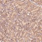 Anti-MMP1 Rabbit Monoclonal Antibody