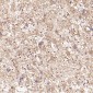 Anti-MMP1 Rabbit Monoclonal Antibody