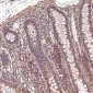 Anti-MMP1 Rabbit Monoclonal Antibody