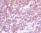 Anti-CCR7 Rabbit Monoclonal Antibody
