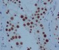 Anti-PARP PARP1 Rabbit Monoclonal Antibody