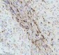 Anti-GFAP Rabbit Monoclonal Antibody